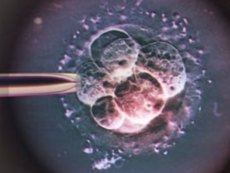郑州合法助孕产子机构_导致郑州胚胎受精失败的原因