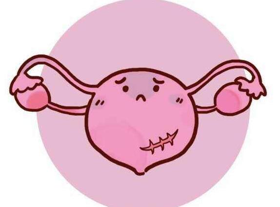 先天性双侧卵巢功能衰竭是否影响不孕妇女的试管婴儿？