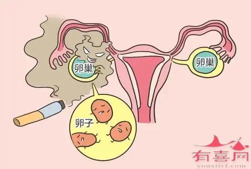 广州哪个医生做试管婴儿最好
