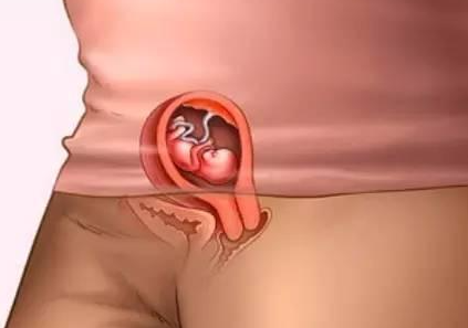 周口助孕龙凤胎qq群：怀孕第10周胎儿稳定吗,胎儿在第10周成形了